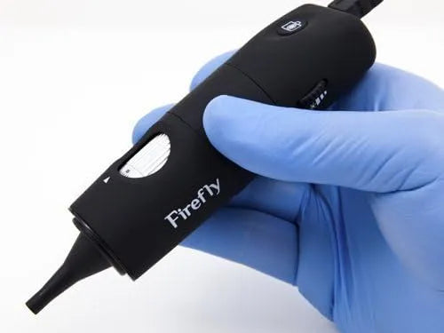 50X DE500 Vidéo Otoscope USB Eclairage LED 50X Firefly DE500